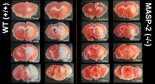 Targeting the complement component MASP-2 significantly limits tissue loss following transient cerebral ischaemia (i.e. a model of stroke) Targeting the complement component MASP-2 significantly limits tissue loss following transient cerebral ischaemia (i.e. a model of stroke)